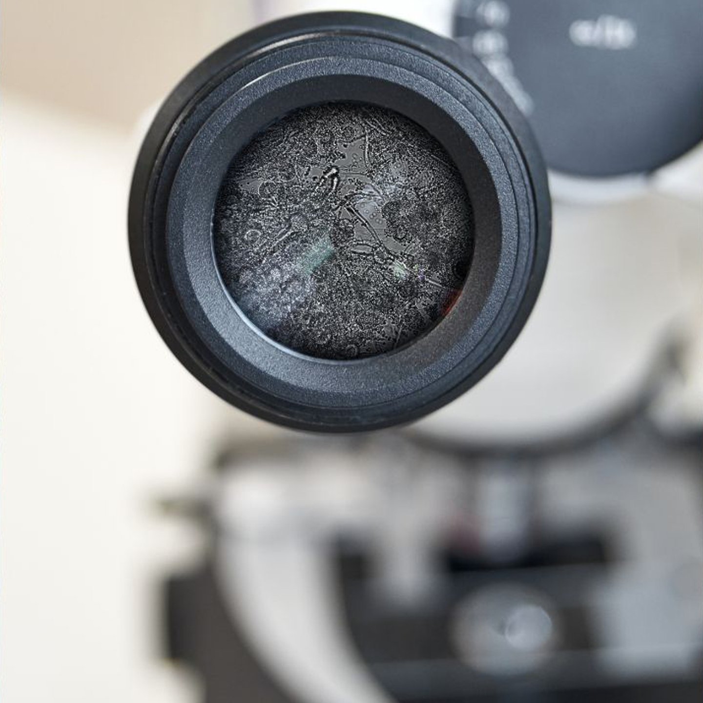 <small>Fungos Aspergillus na Microscopia: </small>Como Afetam as Lentes e Como Evitar