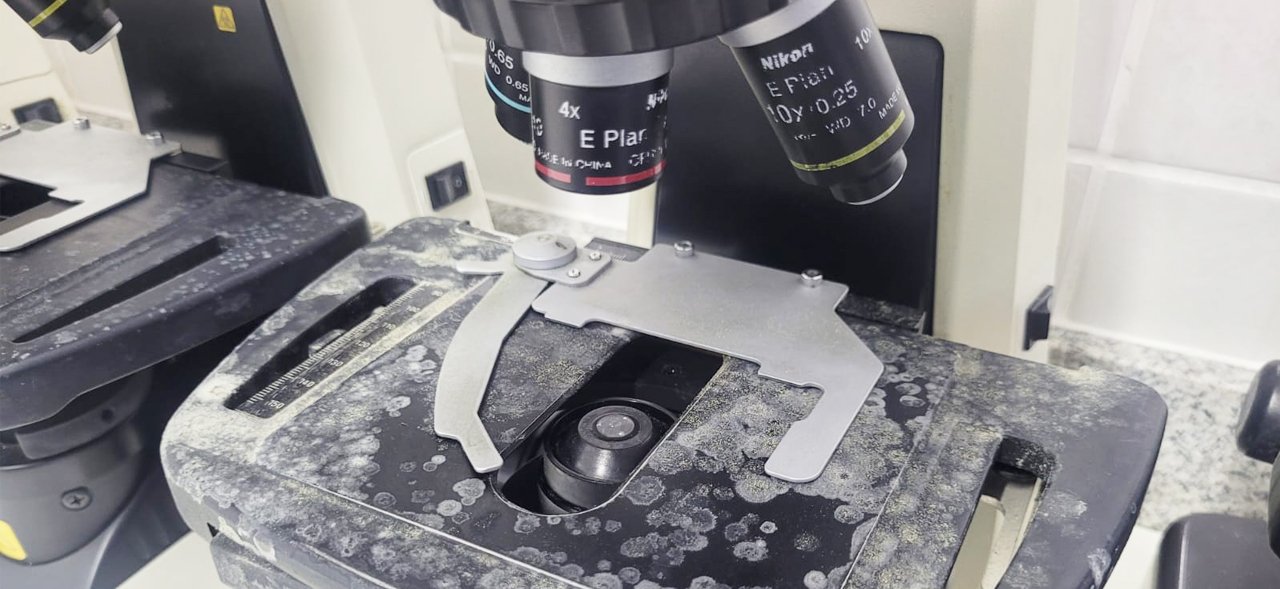 Microscópio contaminado por Fungos antes da recuperação