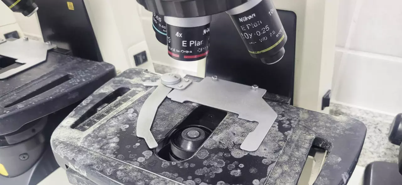 Microscópio contaminado por fungos antes da recuperação técnica
